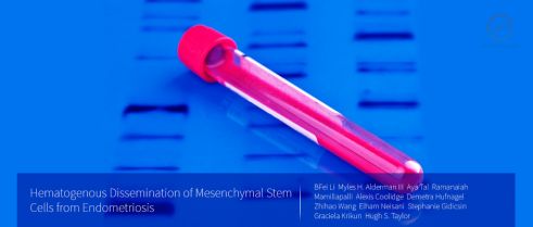 Mechanism for Migration of Endometriosis Cells in the Body