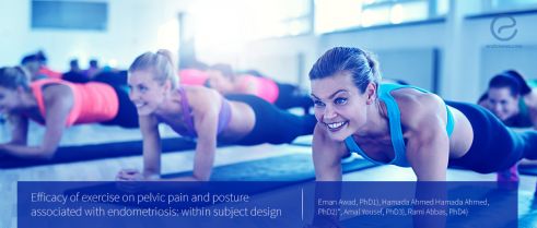 Exercise can improve pelvic pain and posture associated with endometriosis