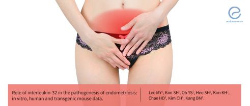 Inflammatory mediators in endometriosis pathogenesis