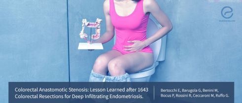 Stenoses in the colorectal anastomose sites after DIE surgery