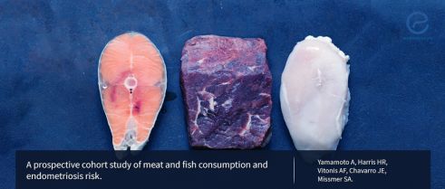 A prospective cohort study examining meat and fish consumption and endometriosis risk.