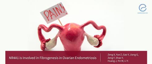 New Target for Endometriosis Treatment?