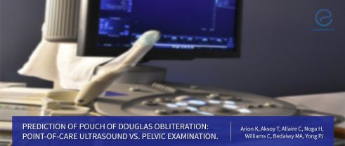 Endometriosis involvement of the pouch of Douglas: TVUS vs pelvic exam