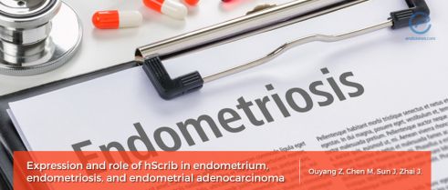The role of adhesion molecules, E-cadherin and hScrib, in endometriosis