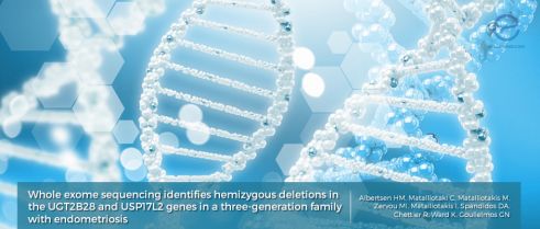 New Link Between Endometriosis and Genetics?