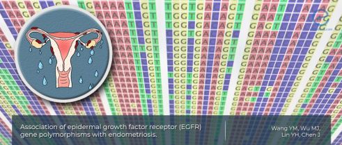 Another Genetic Polymorphism That May Increase Risk of Endo