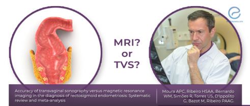 MRI or TVS for accurate diagnosis of rectosigmoid endometriosis?