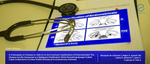 How to Classify Endometriosis for a better and effective evaluation