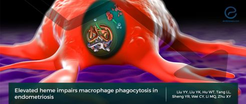 Heme impairs macrophage phagocytosis