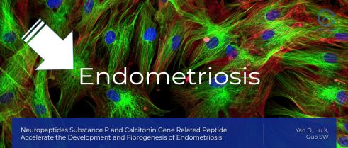 Study Sheds Light on Physiological Processes Associated with Endometriosis