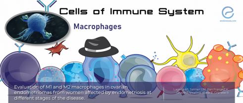 M1 and M2 macrophages in ovarian endometriomas