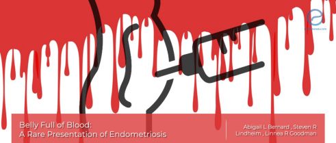 Hemorrhagic Ascites, Belly-Blood: The cause may be endometriosis!