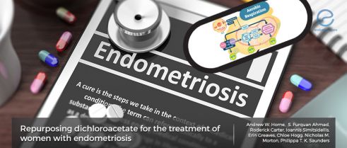 A nonhormonal treatment of endometriosis: Dichloroacetate