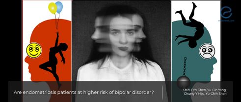 Are endometriosis patients at higher risk of bipolar disorder?