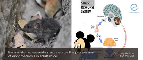 Early maternal separation and endometriosis progression in adult mice 