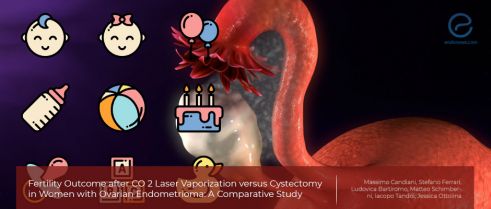 The impact of laser vaporization on reproductive outcomes in women with endometrioma