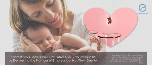 Effect of Endometriosis on IVF Success Rates