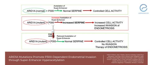 A Possible genetic target for endometriosis treatment