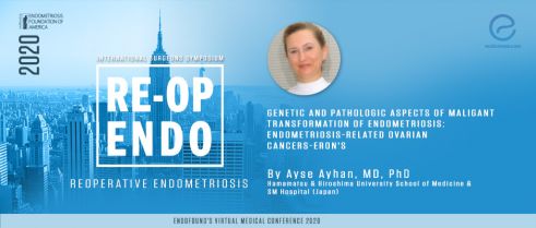 Genetic and Pathologic aspects of Maligant Transformation of Endometriosis: Endometriosis-Related Ovarian Cancers-ERON's - Ayse Ayhan, MD