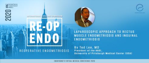 Laparoscopic Approach to Rectus Muscle Endometriosis and Inguinal Endometriosis - Ted Lee, MD