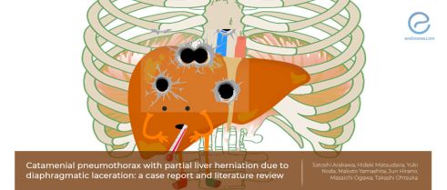 Diaphragmatic defects, liver herniations and catamenial pneumothorax