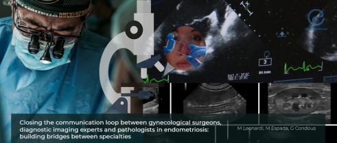 The Communication Gap Between Specialists for Endometriosis Diagnosis and Management