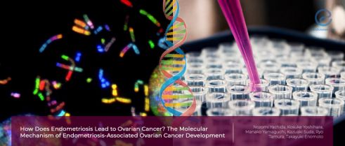 The genomic linkage between ovarian cancer and endometriosis