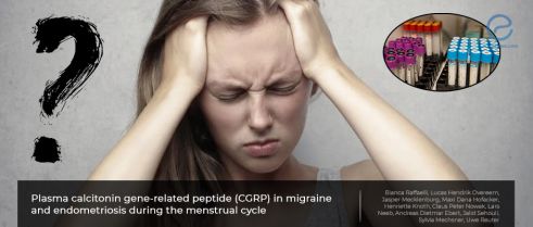 Migraine, endometriosis and plasma 