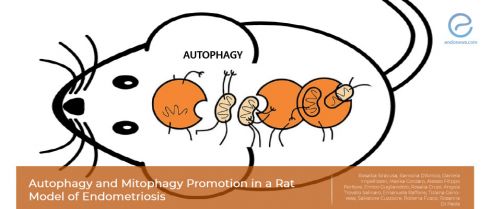 New molecular insights in endometriosis pathogenesis