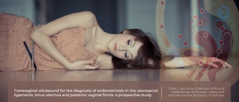 Transvaginal Ultrasound Accuracy for Uterosacral Ligament, Torus Uterinus and Posterior Fornix Endometriosis