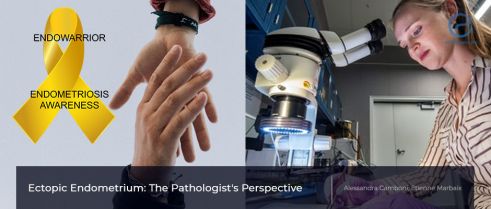 A plea from pathologists: standardized protocols for adenomyosis and endometriosis