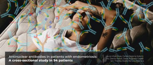 Antinuclear Antibody May Be Linked to Milder Disease in Endometriosis