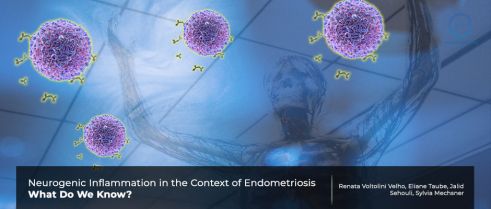 Full understanding the role of nervous system in endometriosis could yield new gateways to novel therapeutic approaches