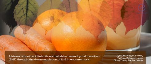 Vitamin A interrupts epithelial-mesenchymal transition in endometriosis