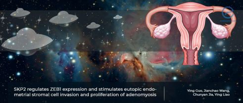 Cancer invasion genes to explain invasiveness of adenomyosis