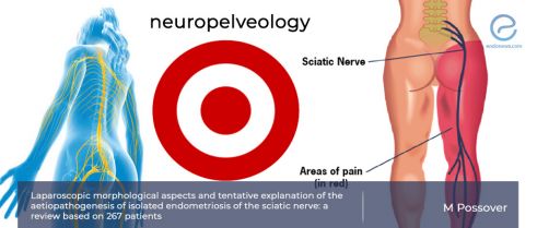 A rare but important disease: 