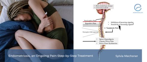 Algorithm for pain management in endometriosis