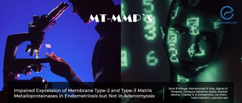 Preferential expression of some membrane type matrix metalloproteinase proteins 