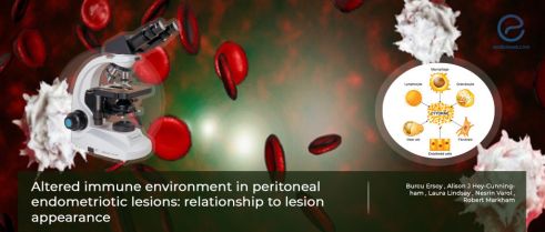 Immune cells in peritoneal endometriosis 