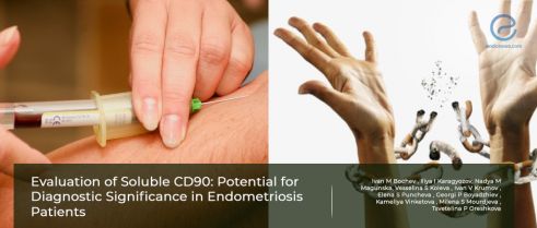 Soluble CD90 : a potential serum biomarker in endometriosis