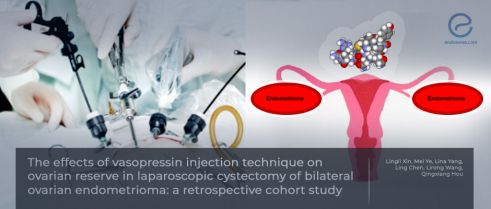 How to reduce follicle loss during endometrioma surgery?