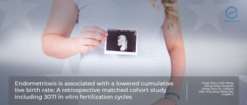 Endometriosis and the cumulative live birth rate in IVF cycles.  