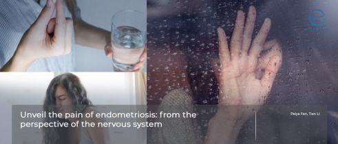  Endometriosis and the possible mechanisms of pain.