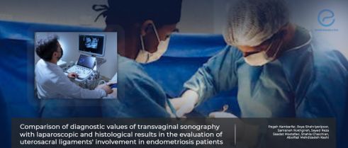 Diagnostic criteria for uterosacral ligament involvement in endometriosis.