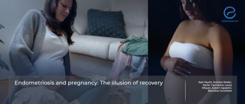 The emotions and experiences of women with endometriosis during and after pregnancy