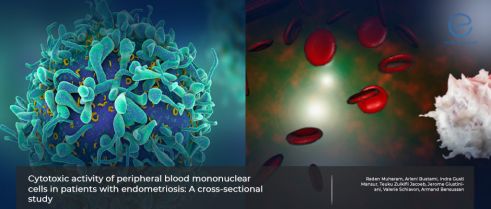 Activities of cytotoxic cells in endometriosis