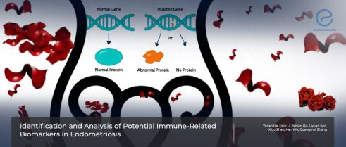 Is the pathogenesis of endometriosis hidden in immune-related gene profiles ?