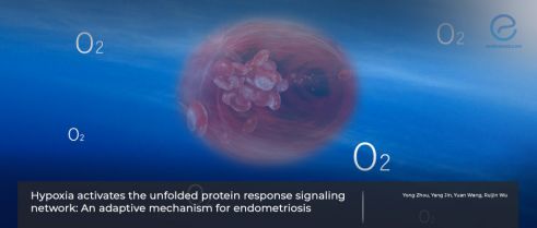 Hypoxia and endometriosis: A review of mechanisms