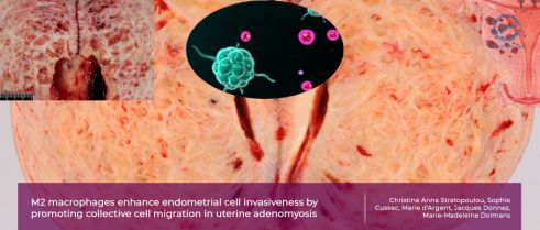 The enhanced invasiveness, migration and the development of adenomyosis: Importance of M2 macrophages