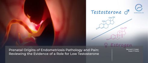 Exploring the Potential Impact of Prenatal Testosterone on Endometriosis